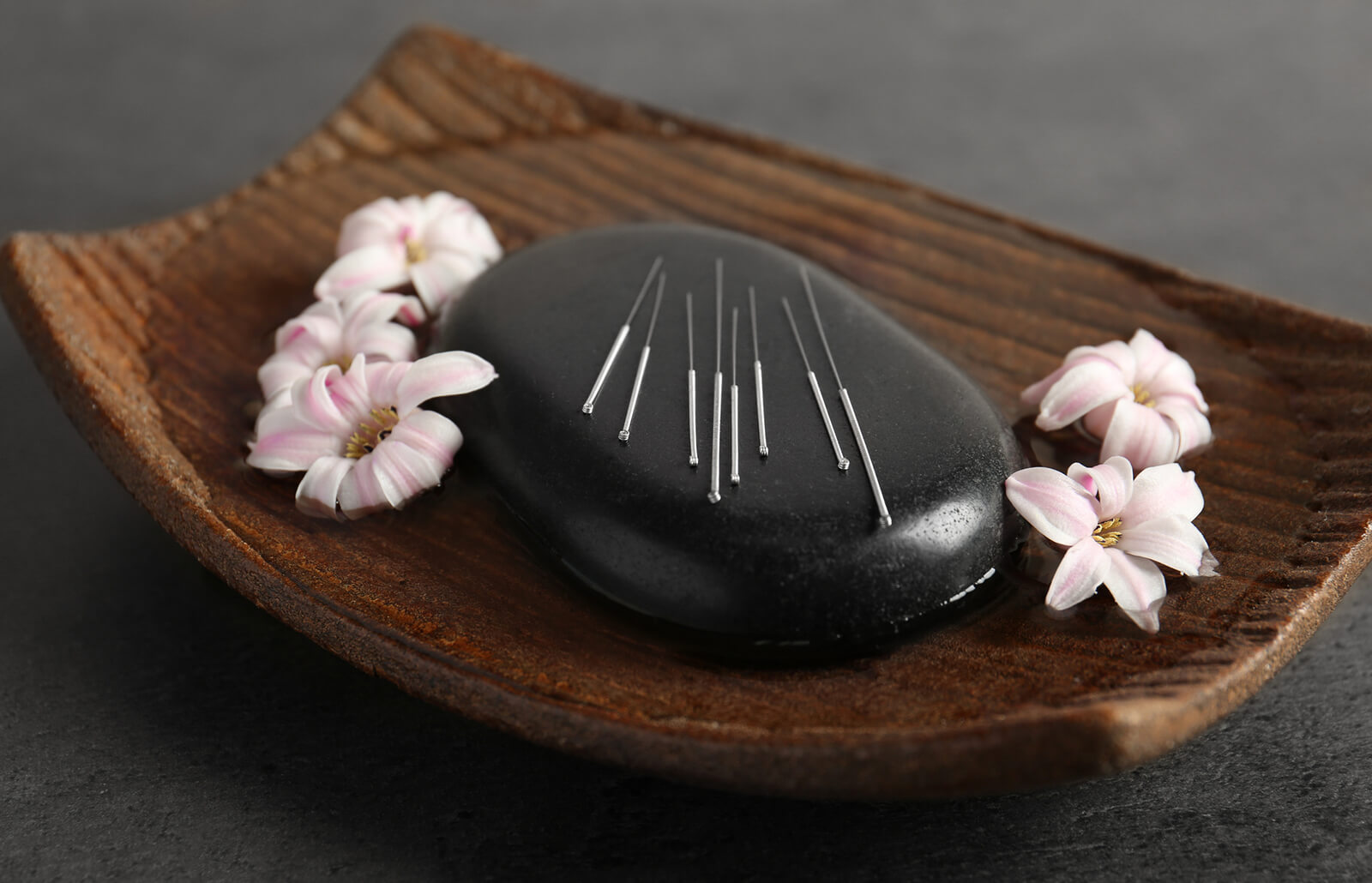 256829-1600x1030-acupuntura-agujas